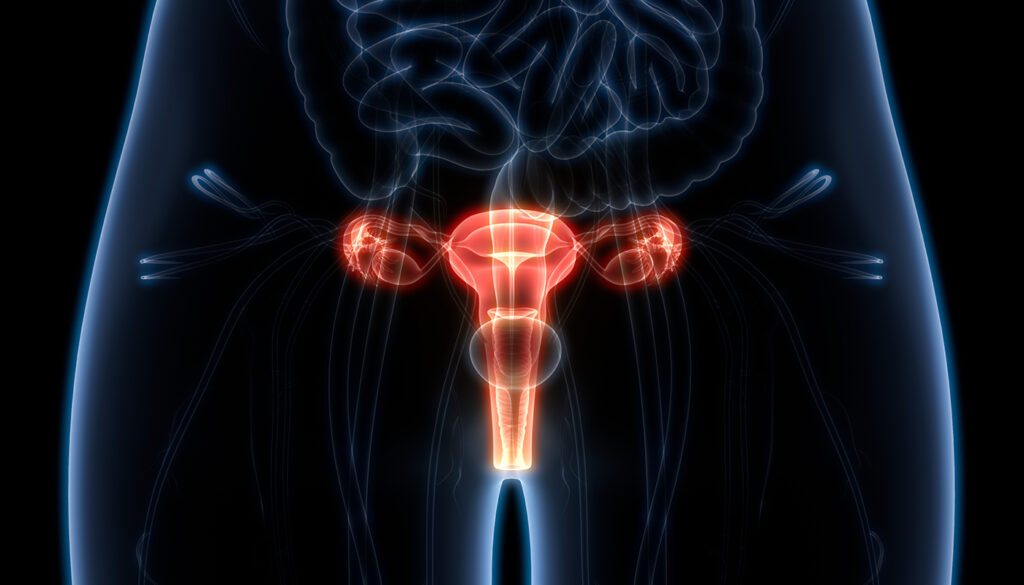 Tumor anexial femenino